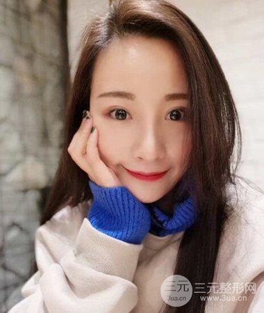 內(nèi)切微創(chuàng)去眼袋手術案例分享，附上手術恢復照片