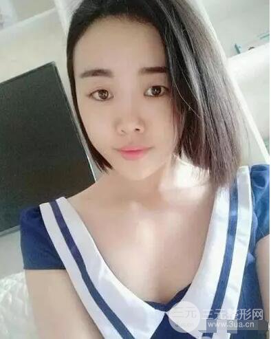 成都玉之光自體脂肪面部填充劉中國真人案例反饋|內(nèi)附對(duì)比前后照