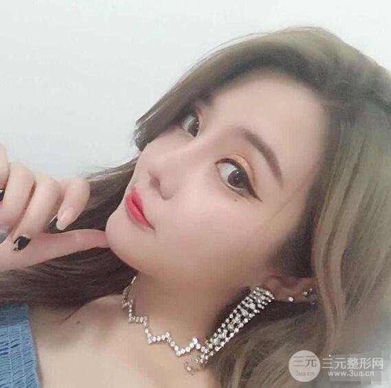 昆明吳氏嘉美李明硅膠隆鼻前后對比圖恢復心情小札