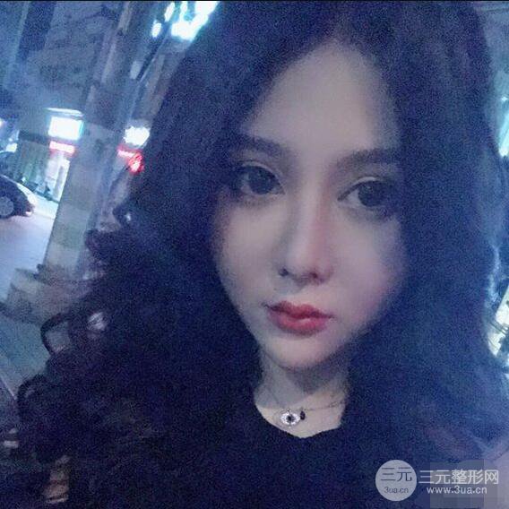 昆明吳氏嘉美李明硅膠隆鼻前后對比圖恢復心情小札