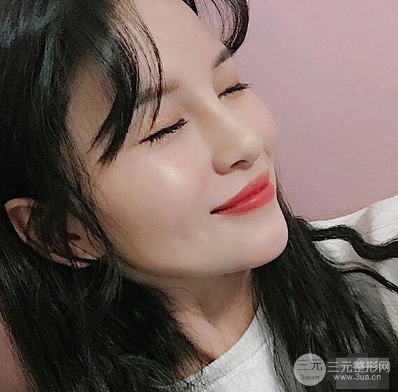 成都華西醫(yī)院整形美容科卿勇隆鼻整形前后對比圖恢復心情小札