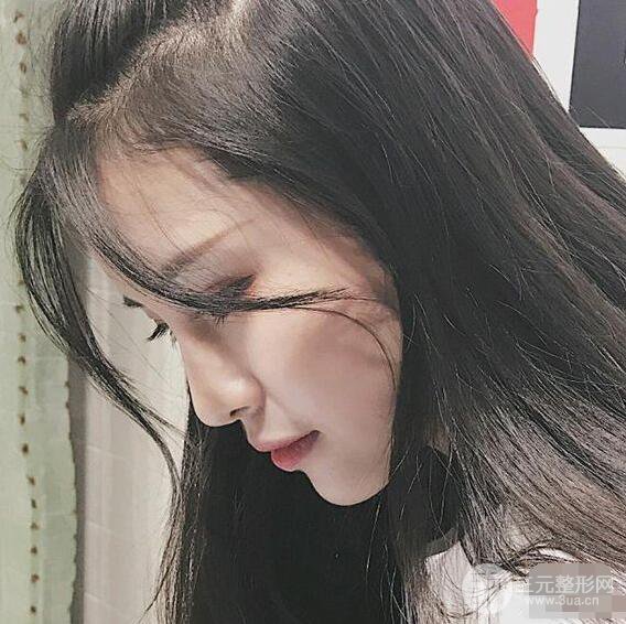 成都華西醫(yī)院整形美容科卿勇隆鼻整形前后對比圖恢復心情小札