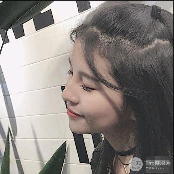 成都華西醫(yī)院整形美容科卿勇隆鼻整形前后對比圖恢復心情小札