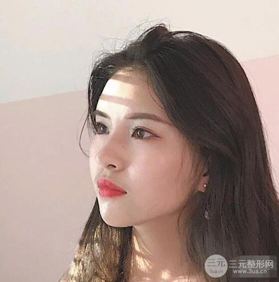 成都華西醫(yī)院整形美容科卿勇隆鼻整形前后對比圖恢復心情小札