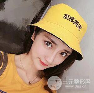 杭州格萊美張樹功假體隆鼻前后對(duì)比圖|內(nèi)附恢復(fù)心情變化哦