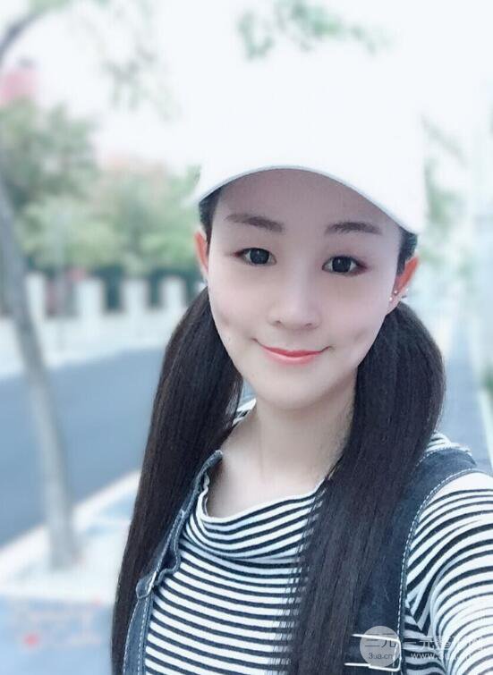 杭州華山連天美高俊明假體隆鼻術前術后對比圖 兩個月恢復心情