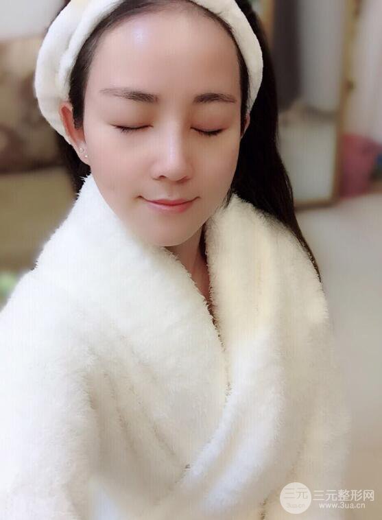 杭州華山連天美高俊明假體隆鼻術前術后對比圖 兩個月恢復心情