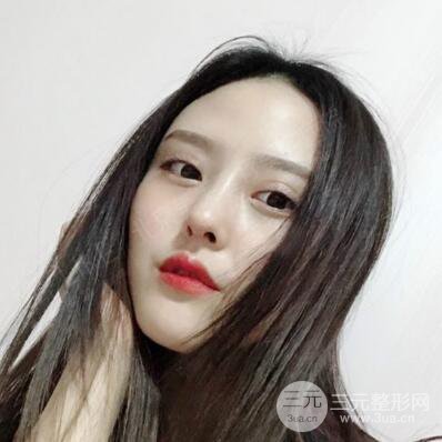 北京美萊趙峻賢隆鼻整形真實案例對比圖恢復過程分享