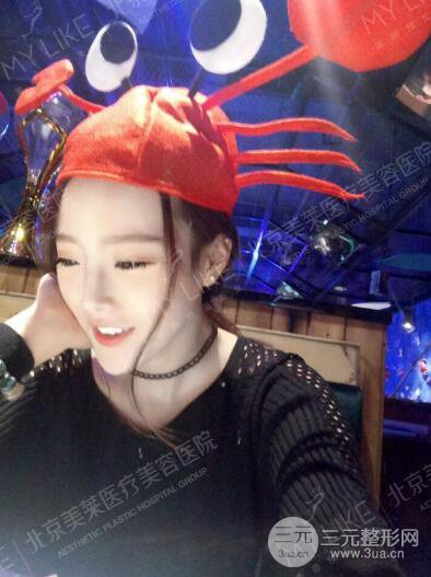 北京美萊趙峻賢隆鼻整形真實案例對比圖恢復過程分享