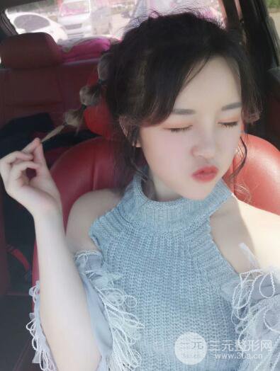 成都天使之翼張勁松切開雙眼皮案例前后對比圖心情小札