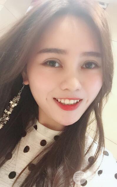 松原齊飛整形割雙眼皮真人案例前后對(duì)比圖日扎分享