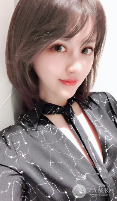 常州施爾美廉鋒自體脂肪豐臉對照圖案例心情日扎