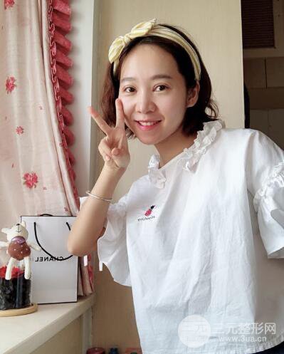 湘潭華美切開雙眼皮案例對照圖兩個(gè)月恢復(fù)過程心情日扎