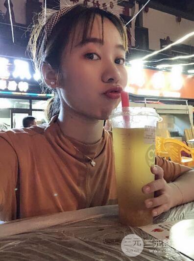 湘潭華美切開雙眼皮案例對照圖兩個(gè)月恢復(fù)過程心情日扎