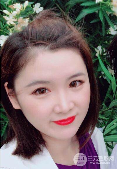 貴陽(yáng)美萊梁潔芭比媚雙眼皮多項(xiàng)整形前后對(duì)比圖恢復(fù)心情小札