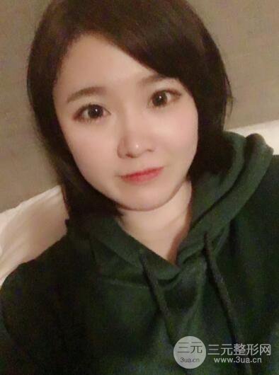 貴陽(yáng)美萊梁潔芭比媚雙眼皮多項(xiàng)整形前后對(duì)比圖恢復(fù)心情小札