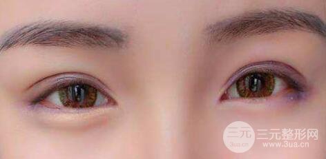 激光祛眼袋疼不疼?激光祛眼袋有什么副作用