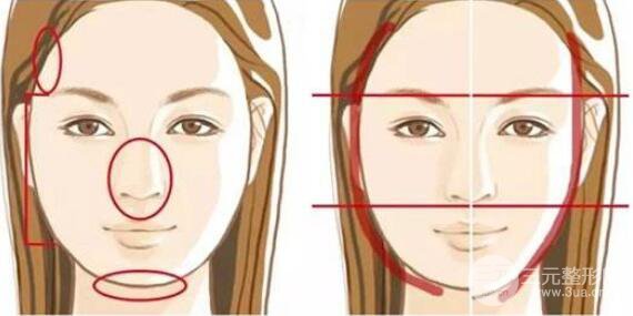 磨腮削骨多久后能恢復?哪些因素影響到恢復時間?