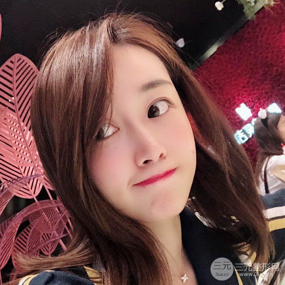 【術(shù)后3天即可上妝】大V.線 定點(diǎn)提拉 讓臉“嘭嘭嘭”！