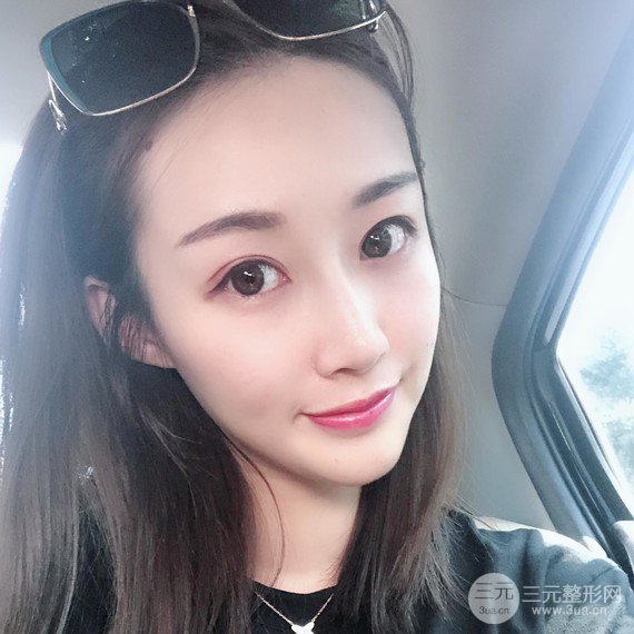 【術(shù)后3天即可上妝】大V.線 定點(diǎn)提拉 讓臉“嘭嘭嘭”！