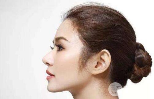 成都自體耳軟骨隆鼻果怎么樣?果好不好？