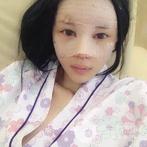 自體細(xì)胞注射