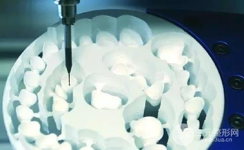 成都全瓷牙材料差別