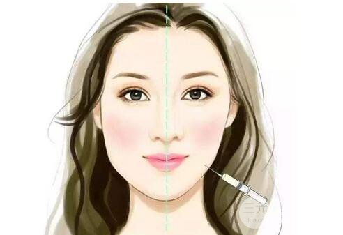 注射瘦臉多少錢(qián)