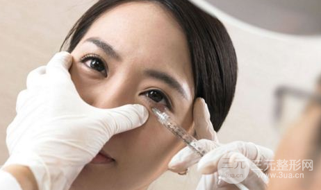 眼袋抽脂術原理及果