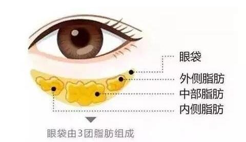 什么是眼袋?