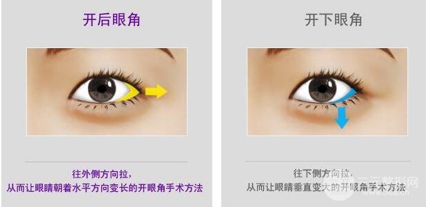 開眼角有什么危害？