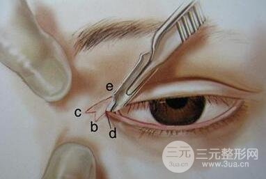 開眼角有什么危害？