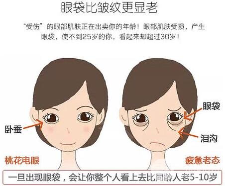激光去眼袋多少錢？貴嗎？別讓你的眼袋越變越大！