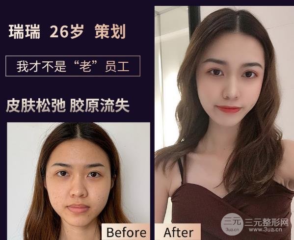 熱瑪吉的緩解過程