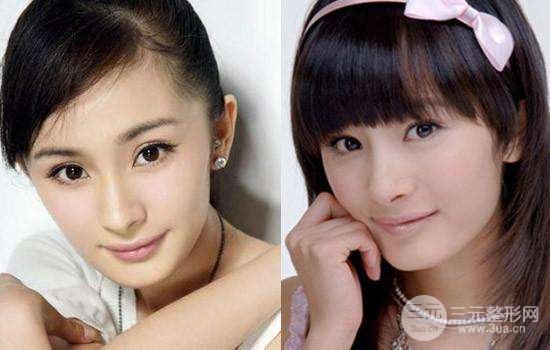 磨腮削骨多少錢？別怕貴，降低風(fēng)險(xiǎn)才重要！