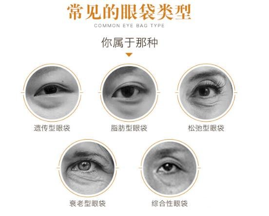 激光去眼袋原理介紹