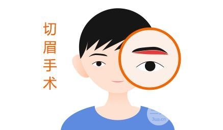 切眉術(shù)會(huì)留下疤痕嗎?