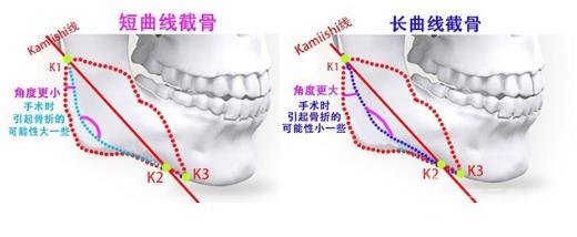 選取醫(yī)院不同