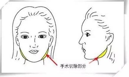 自身?xiàng)l件不同