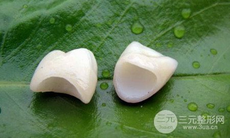 美容冠多少錢一顆？費用解析大全~