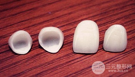 美容冠多少錢一顆？費用解析大全~