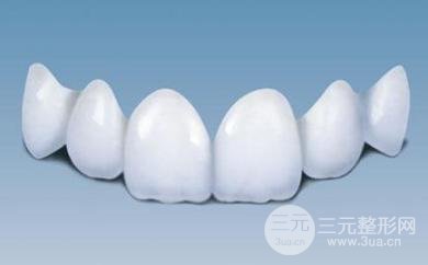 #揭開內(nèi)幕#各種烤瓷牙的價(jià)格是多少？提前了解一下~