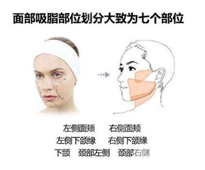 光纖溶脂瘦臉是長時間的嗎？維持時間是多長？