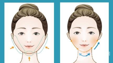 光纖溶脂瘦臉適合人群