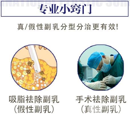 副乳吸脂