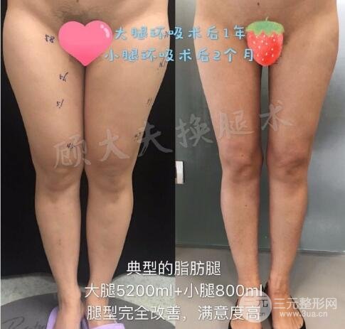 如何避免風(fēng)險和副作用