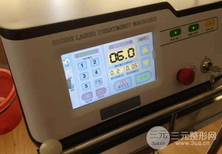 面部光纖溶脂有什么副作用嗎