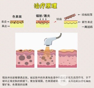 復(fù)合彩光嫩膚的作用