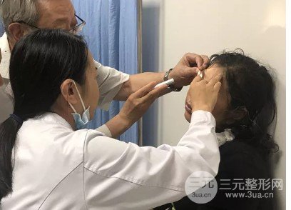 抽脂去除眼袋降低風險嗎