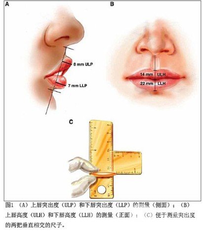玻尿酸豐唇多少錢一針